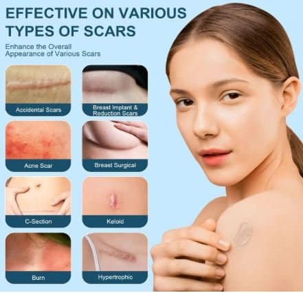 benefits of black castor oil​